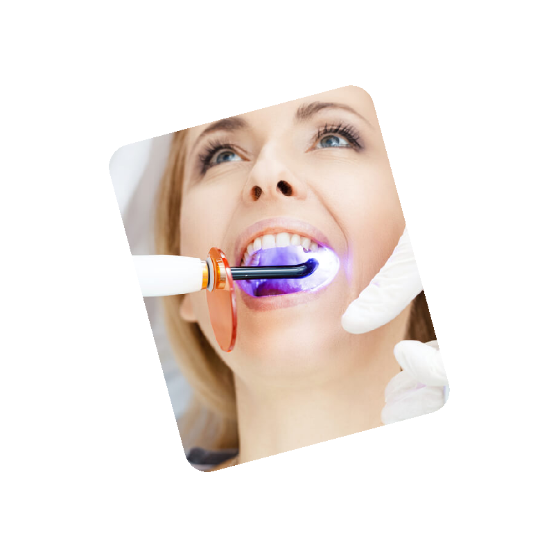 <b>Wybielanie laserowe</b>